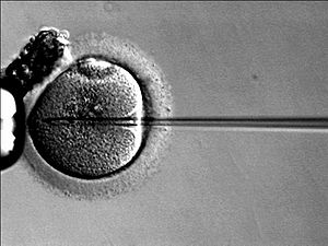 Inyección de un ovocito con espermatozoide