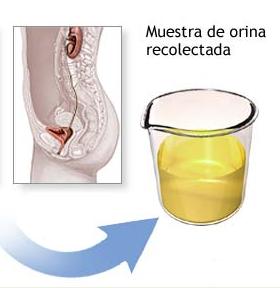 Recolección de orina para el test de ovulación