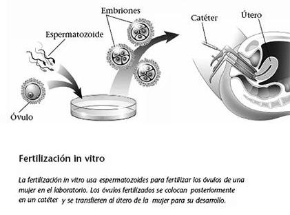 Proceso de fertilizacición in vitro