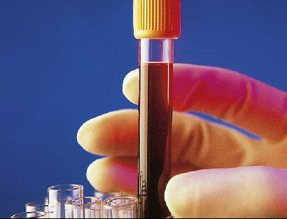 Test de Ovulación en sangre